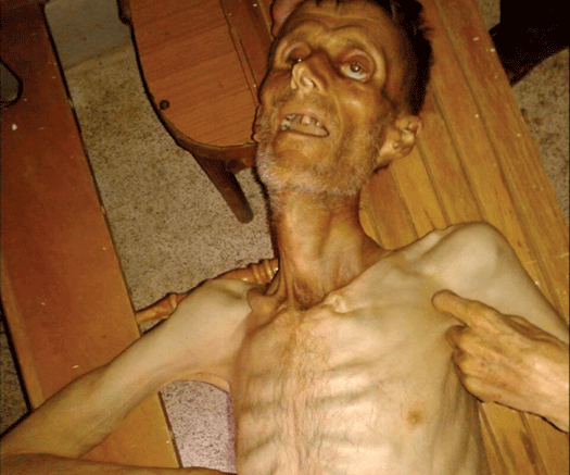   به‌ وێنه‌.. منداڵانی مه‌زایا له‌ برسان ده‌مرن